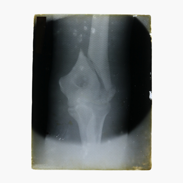 XRay Plates 11450 Sgt Edward Davies MM Collection